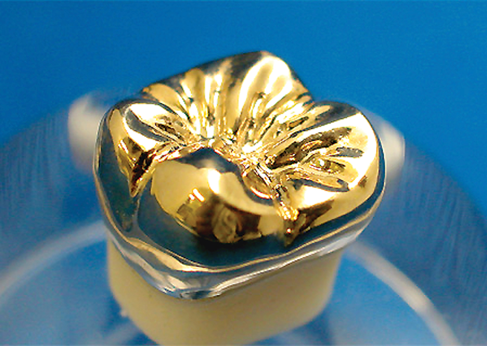 ゴールドクラウン